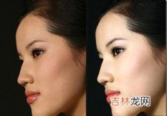 既便宜又有效果的美白面膜