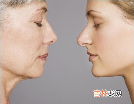 女性皮肤为何老得快