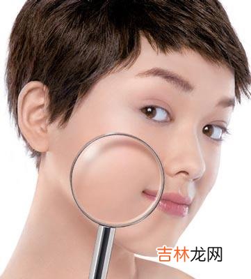 小心!皮肤敏感不是过敏