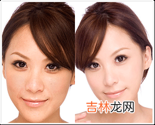 医生：女性打美白针有效实系药物“副作用”
