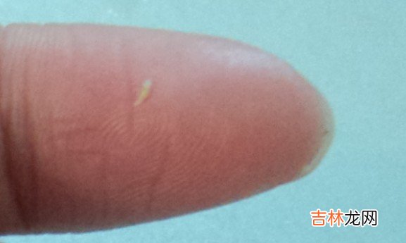 眼霜选对了 脂肪粒也就不见了