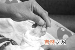 使用化妆品谨防过敏综合症