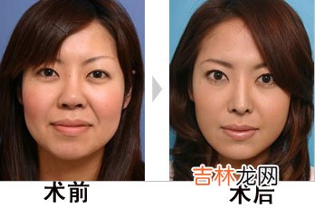 教你掌握延缓衰老的金钥匙