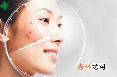 美白方法贴心纠错不入误区
