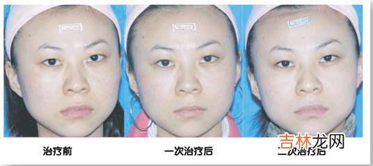 如水的女人食出细腻美肤