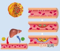 运动能保持血脂水平正常