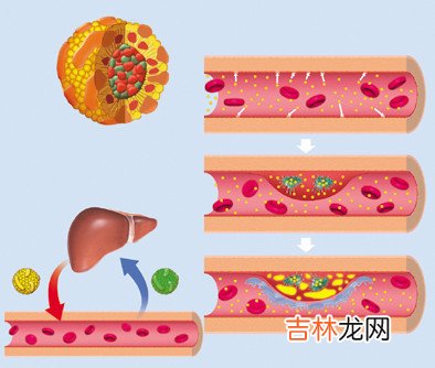 运动能保持血脂水平正常