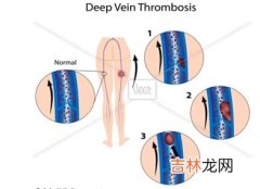 幸福医学向女性招手