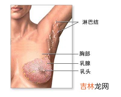 20年后乳腺癌将是我国发病率最高的恶性肿瘤