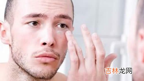 男士肌肤应该如何护理请关注