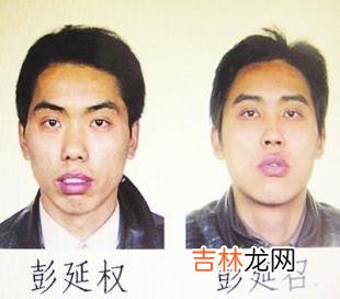 1 男人整容十五条必看问答