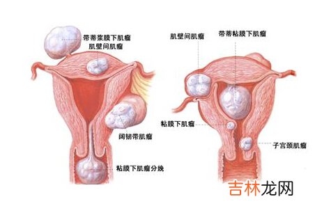 五种患病女性不宜性生活