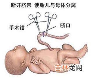 广东一孕妇同时经历剖腹产和心脏换瓣复杂手术