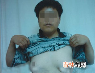 男孩的乳房硬块是怎么回事