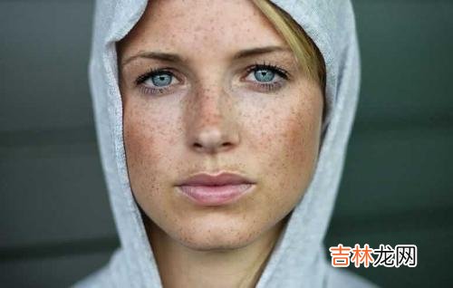驱走黄褐斑再现脸上光彩