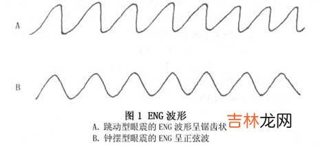 眼球震颤