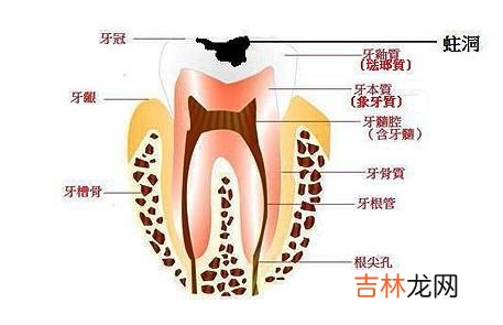 什么是可复性牙髓炎什么是不可复性牙髓炎