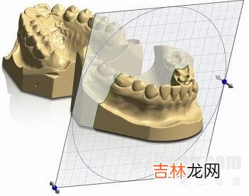 什么是咬合重建