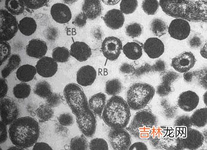 司帕沙星治疗生殖道沙眼衣原体感染48例