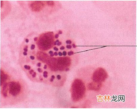 淋球菌染色体mtrR基因突变对淋球菌多重耐药性的影响