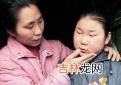 无汗性外胚叶发育不良伴毛发红糠疹一例