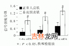 白介素1β诱导正常人皮肤表达银屑病免疫病理表型