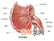 系统性红斑狼疮并发全结肠坏死及穿孔一例