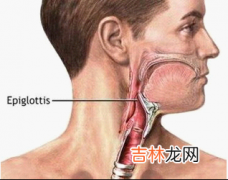 急性会厌炎的病状