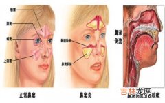 常用的鼻窦检查方法有哪些