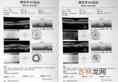 中浆应该怎样治疗