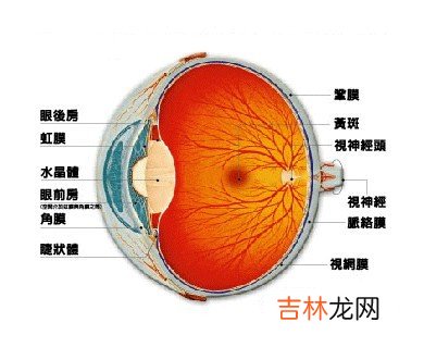 得了视网膜色素变性眼底有什么改变常见并发症有哪些