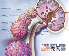 二步聚合酶链反应检测皮肤T细胞淋巴瘤的T细胞受体基因重排