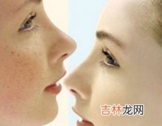 你知道吗女人抗斑从小就要做起