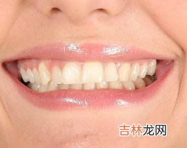 根部防蛀健康牙齿