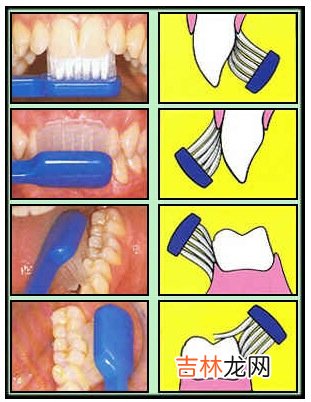怎样做才算正确的刷牙