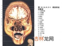 筛窦恶性肿瘤主要引起哪些症状和体征