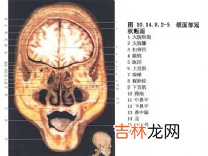 筛窦恶性肿瘤主要引起哪些症状和体征