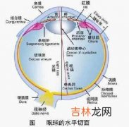 视网膜脱离有哪些易患因素