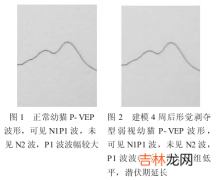 什么形觉包括哪些内容