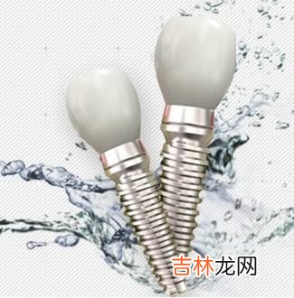什么情况可制作全口覆盖义齿