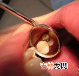 在什么情况下不能施行拔牙手术