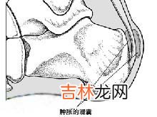 局部麻醉时怎样预防并发症的发生