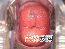 阴道出血月经还是宫外孕