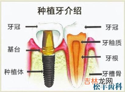 全口牙以什么原则排列