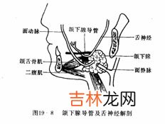 什么是涎石病怎么做涎石摘除术