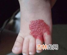 涎腺损伤后什么救治方法