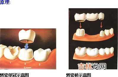 口腔修复