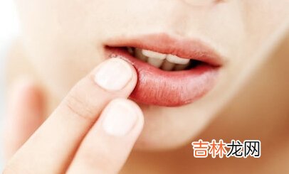 口唇干裂者应如何选择饮食