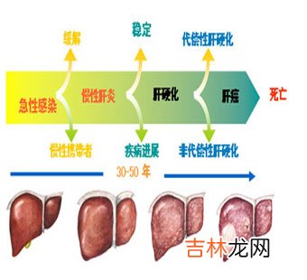 两组代偿性肝硬化治疗效果比较