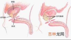 前列腺特异性抗原早期诊断前列腺癌的研究进展